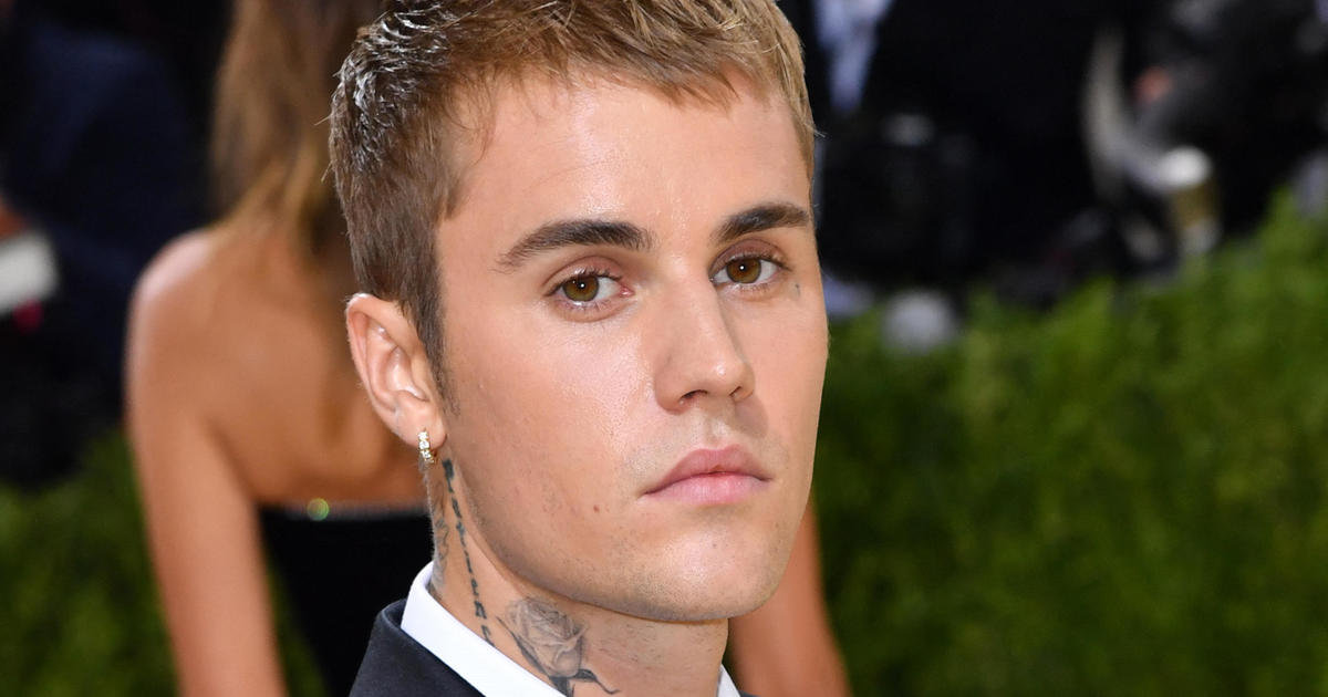Justin Bieber says he has facial loss of motion because of Ramsay Hunt disorder